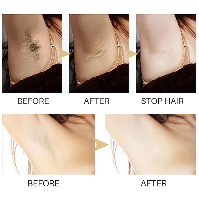 Natural Herbal Hair Inhibition Serum