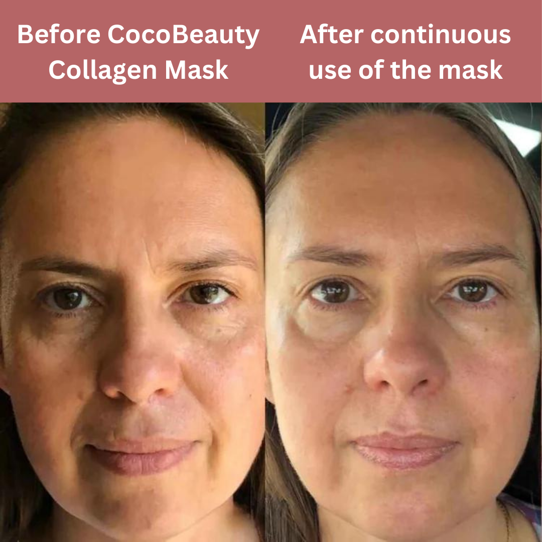 Bio-Collagen Mask